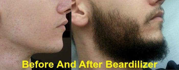 Beardilizer Before & After